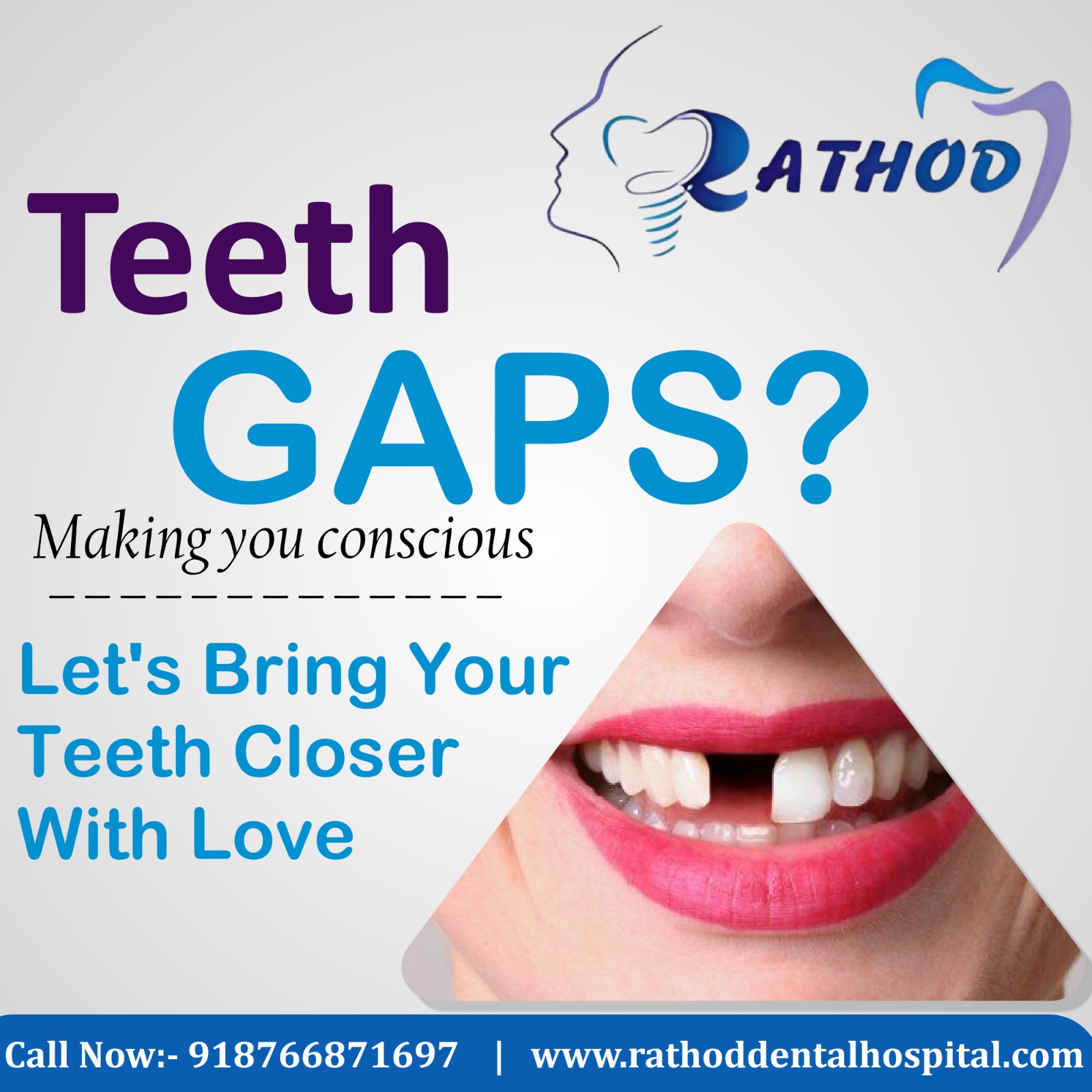 It’s time to smile with confidence again – only at Rathod Dental Hospital! 💫