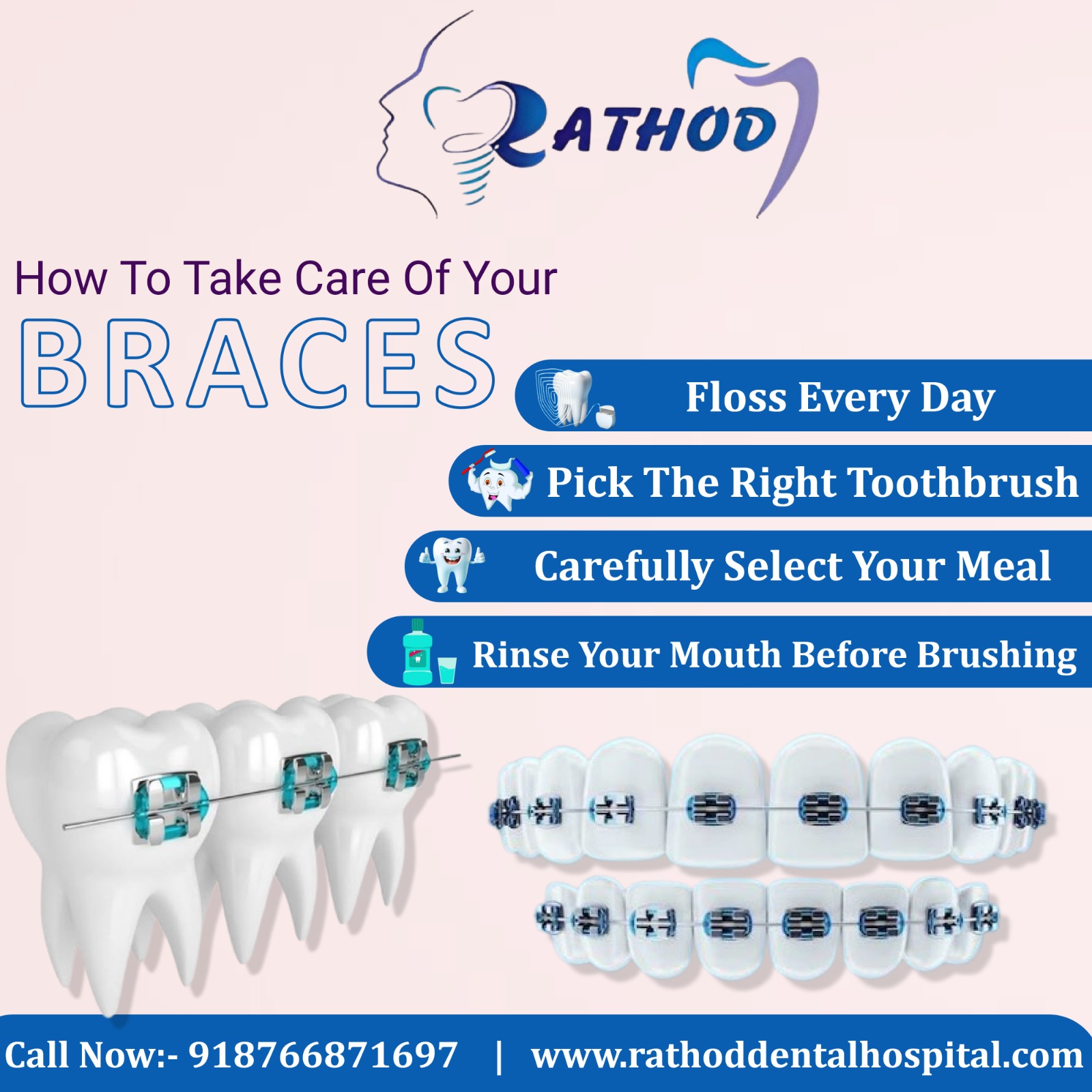 Wearing Braces? Here’s How to Take the Best Care of Your Smile!