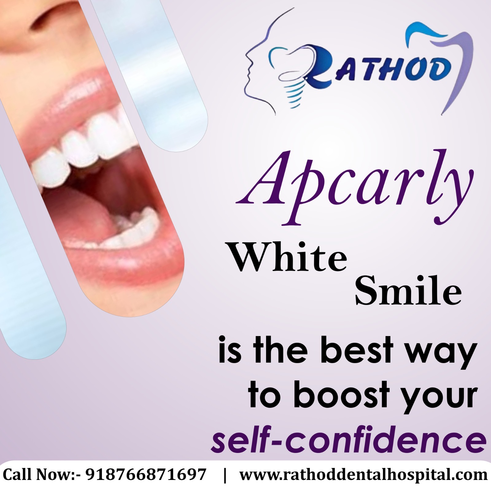At Rathod Dental Hospital, we believe that a beautiful smile isn't just about appearance—it's about boosting your self-confidence and making a lasting impression