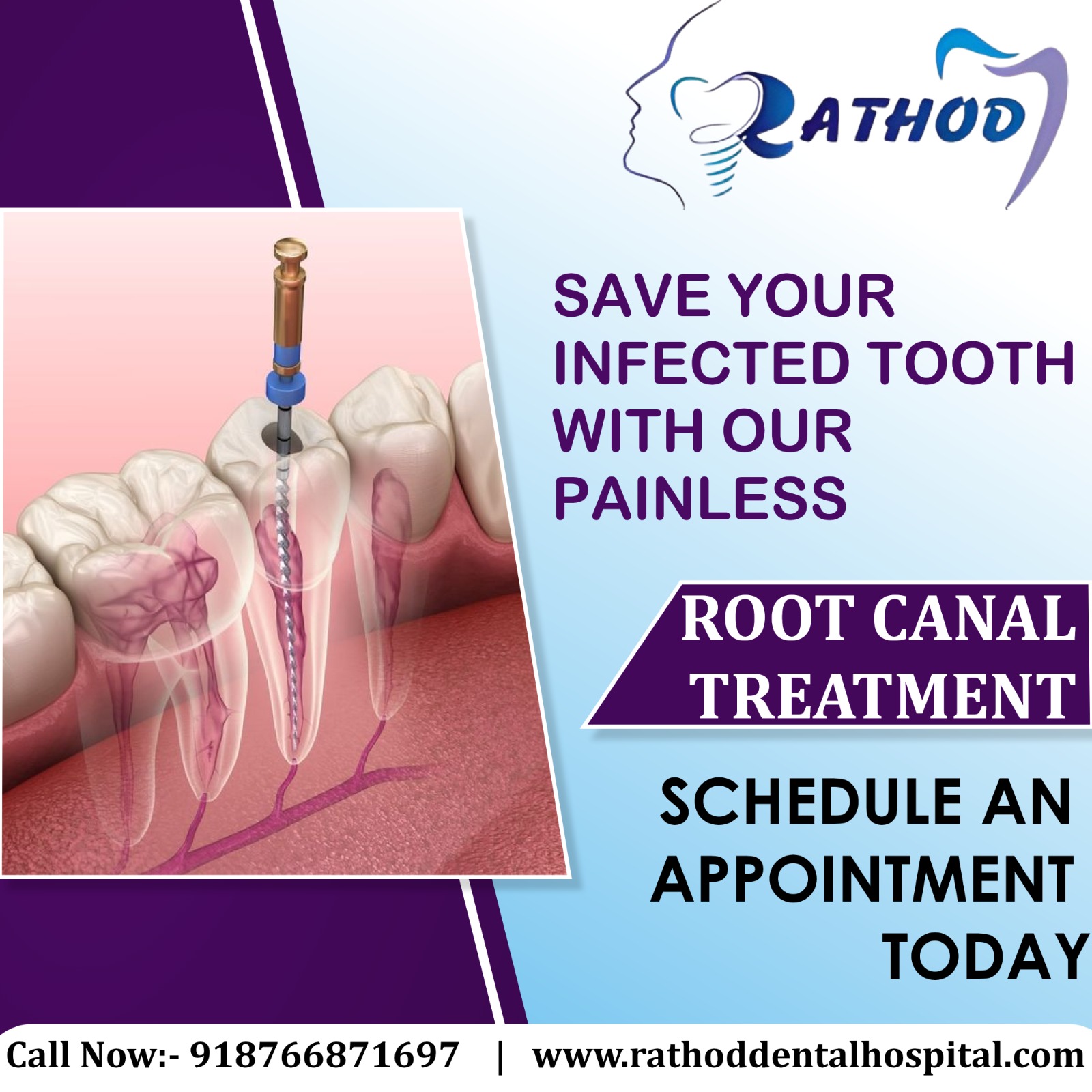 Say Goodbye to Tooth Pain!