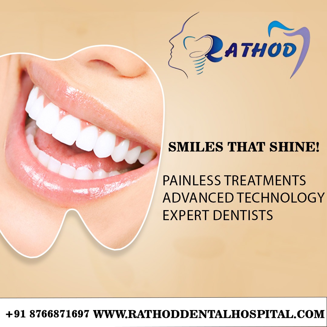  Your Smile, Our Priority – Rathod Dental 