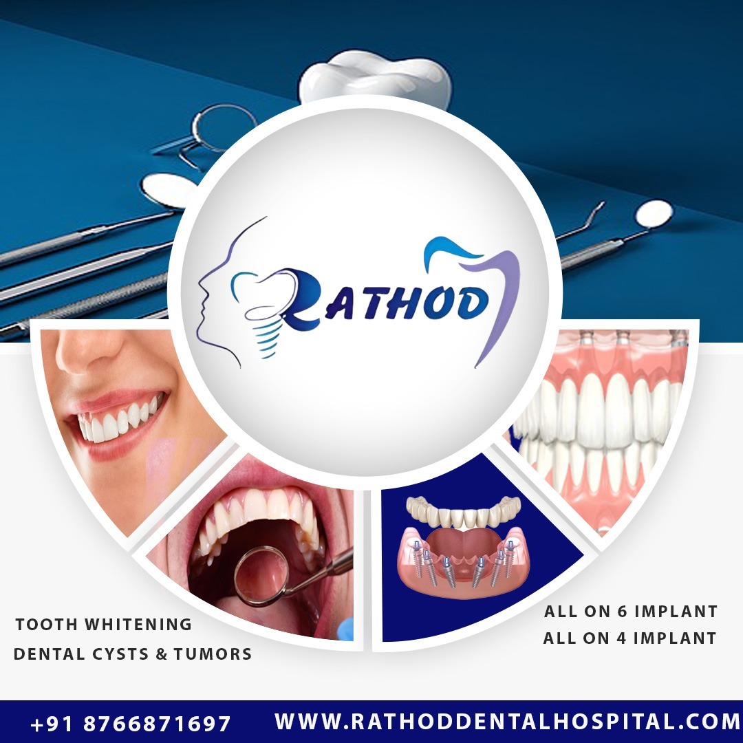 RATHOD DENTAL HOSPITAL – Your Smile, Our Passion! 