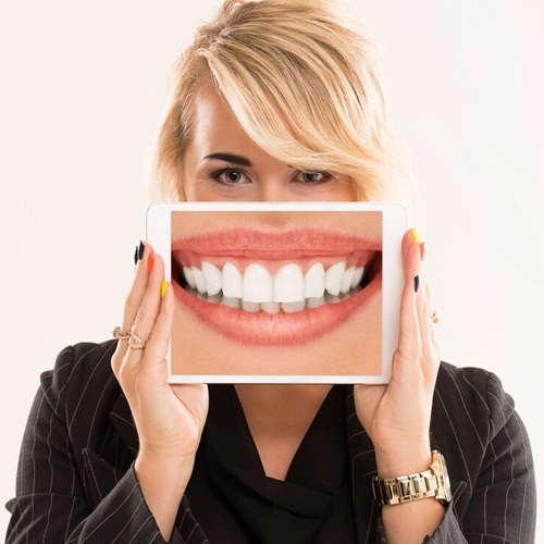 Digital Smile Designing